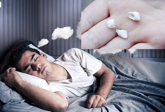Mơ thấy răng rụng có thực sự là điềm xấu?
